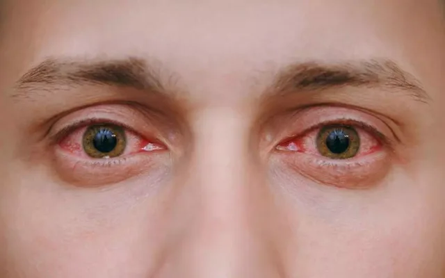 409876-eye