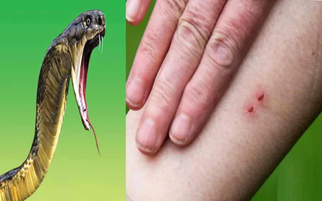 snake-bite